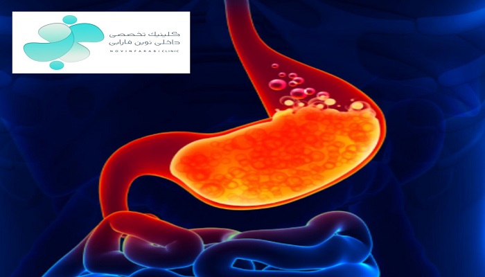 رفلاکس معده_ معده _ علت رفلاکس معده