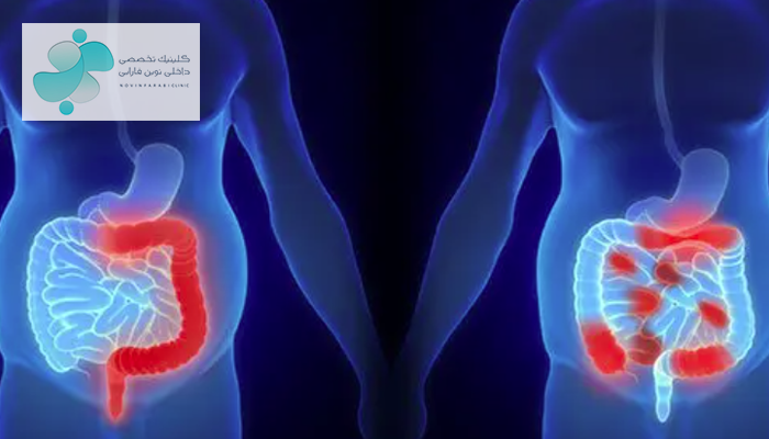 تفاوت IBD و IBS